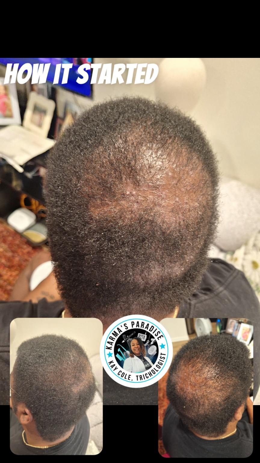 Starting crown progress collage